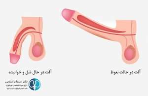 نعوظ چیست و چه علائمی دارد