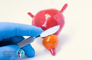 جراحی پروستات