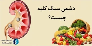 دشمن سنگ کلیه