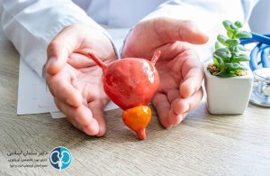 پاکسازی پروستات